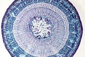 A micrograph of a cross-section of a tree branch showing the cell wall and other materials