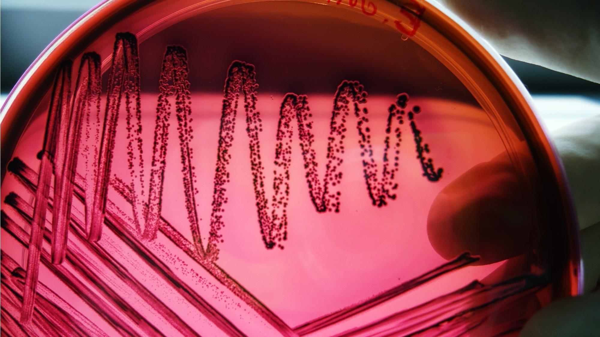 Exceptional enzymes | Feature | RSC Education