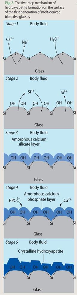 Figure 3 - the five-step mechanism of hydroxyapatite formation on the surface of the first generation of melt-derived bioactive glass