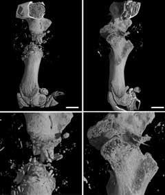 Bone scan 28 days after two different types of scaffold implantation. Using new materials could enhance the body's bone repair mechanisms