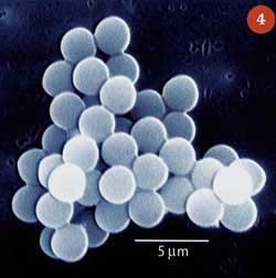 Figure 4 - Protein microspheres produced by sonochemistry