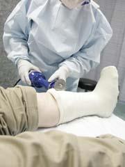 A doctor removing a leg cast