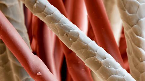 A magnified image showing large cords, some smooth and some scaley