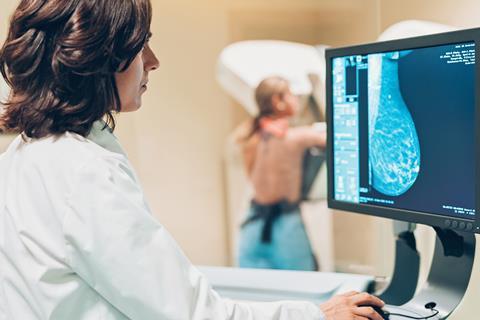 A photo of a technician taking a mammogram for a woman in the background