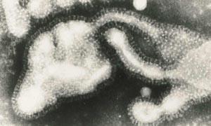 Figure 2 - Electron micrograph of influenza virus