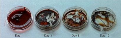 Blood samples after 1 day, 3 days, 8 days and 15 days