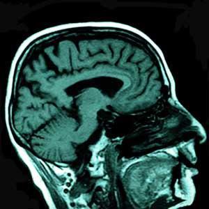 Figure 2 - MRI scan of the human brain