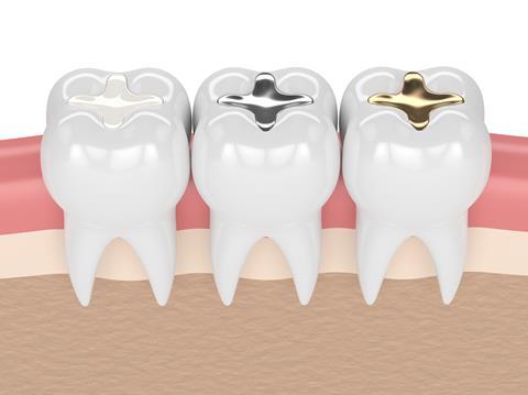 A digital illustration of three teeth with ceramic, amalgam and gold fillings